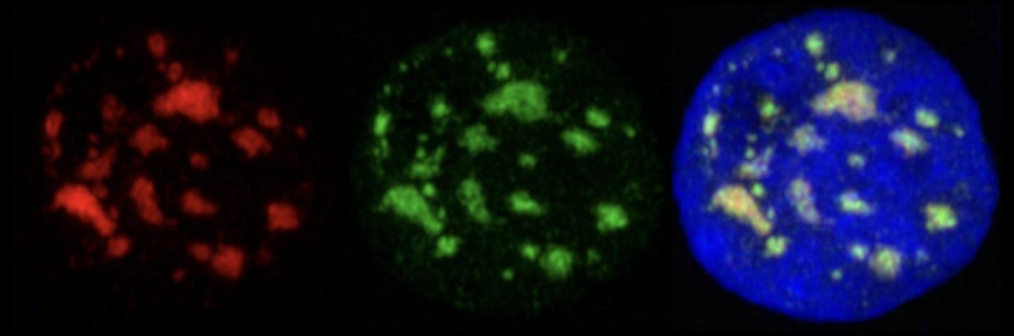 Human Cell Nucleus under the Microscope