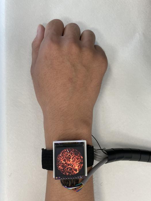 Photoacoustic imaging watch