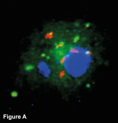 Figure A -TB Before Autophagy