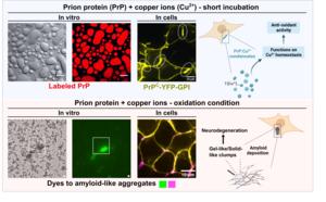 Prion protein & copper interaction