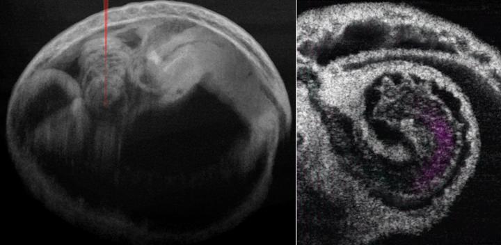 Mouse Embryo and Heart with Blood Flow