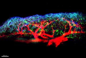 Respiratory allergies: newly discovered molecule plays a major role in triggering inflammation