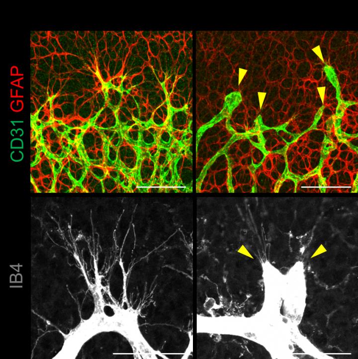 YAP/TAZ Regulates Vascular Sprouting and Growth