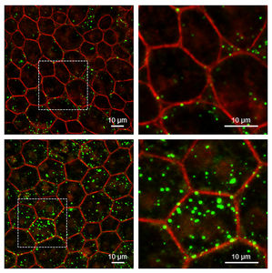 Retinal pigment epithelium in wild-type and Serpin1-null mice