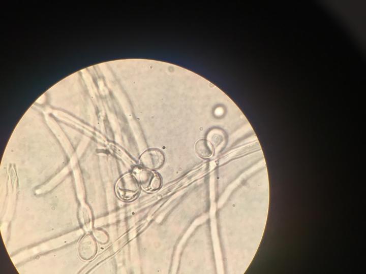 <i>Ambrosiozyma monospora</i>