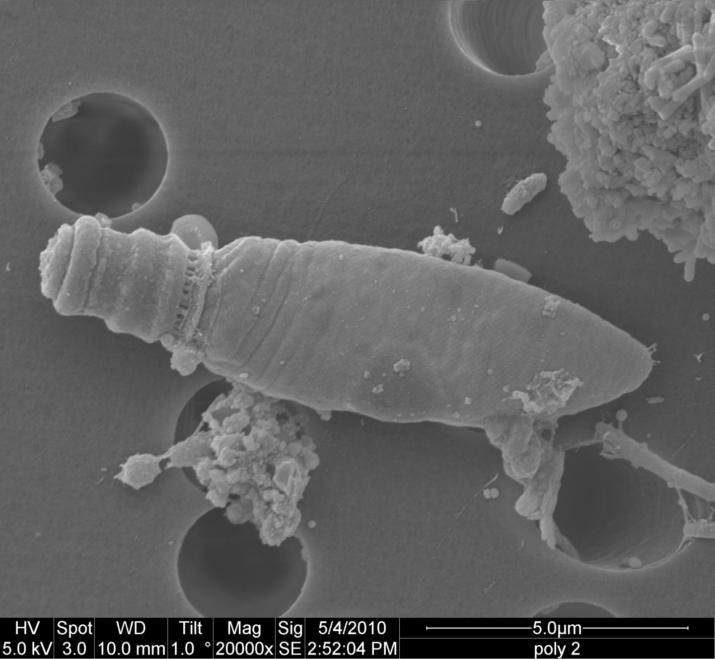 Evolution of Complex Ballistic 'Harpoons' in Microbes (7 of 11)