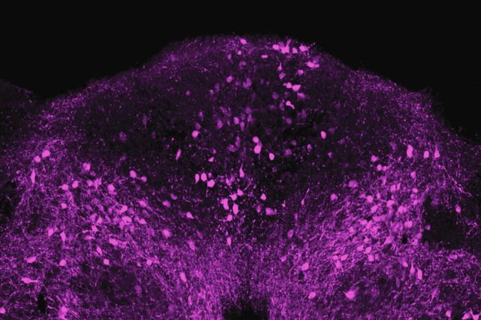 Sickness neurons