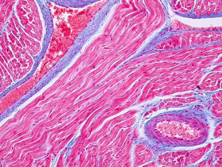 Muscle Tissue