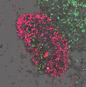 Natural killer cells at work