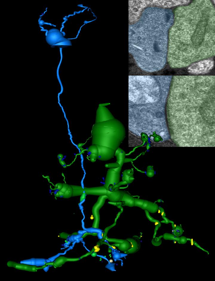 2-D pathoconnectome image: Two retinal neurons