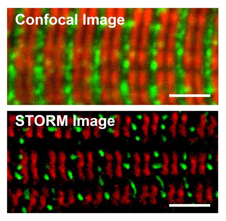 MyosinBinding Protein C is Key to Healthy He EurekAlert!