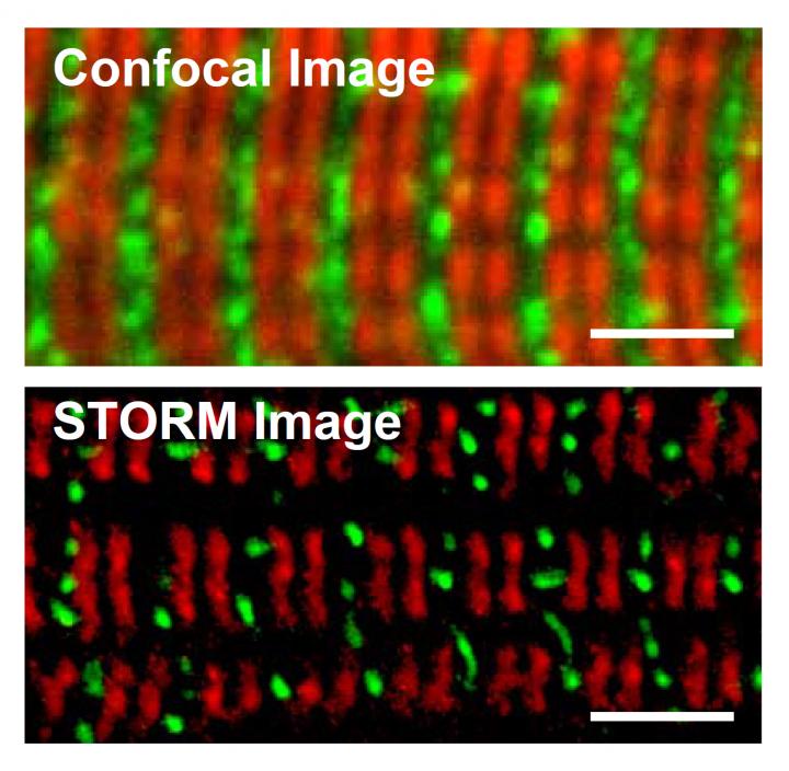 Myosin-Binding Protein C is Key to Healthy Heartbeats (2 of 2)