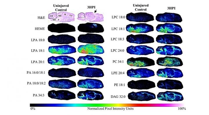 TBI Biomarker Shows Promise to Support Rapid Damage Evaluation & Predict Outcomes