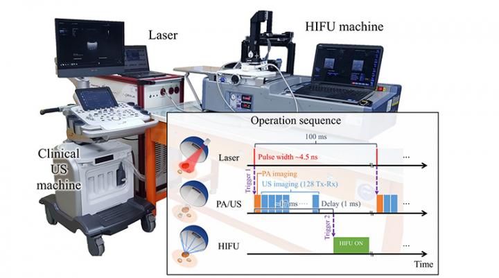Photoacoustic Thermometry and Ultrasound Imaging System Integrated with HIFU Treatment System