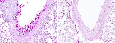 Production de mucus dans le poumon après inhalation d’un allergène, en présence ou non du capteur IL-33 (coupes de poumon, coloration du mucus en rose magenta).  