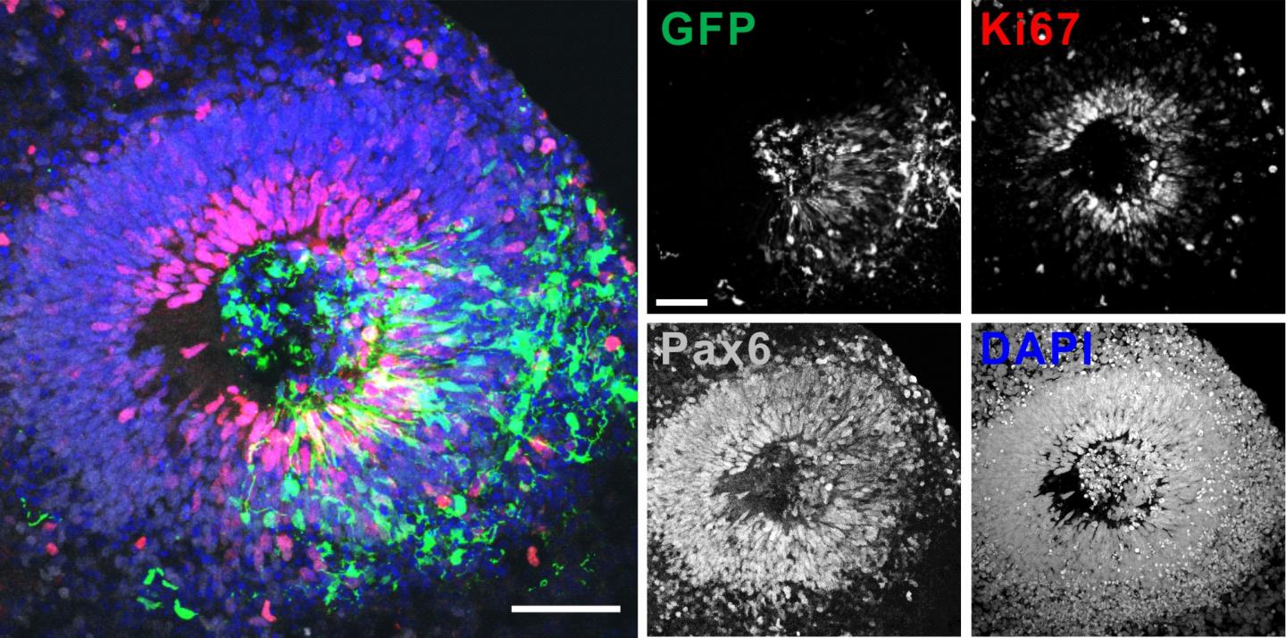 Human Brain Organoid Specimens Derived from Fibroblast of a Healthy Person