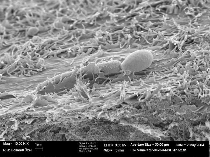 <I>Candida  tropicalis</I>