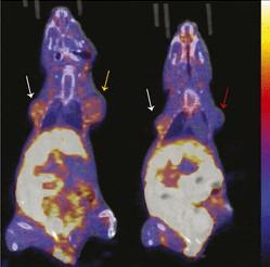18F-FFNP Uptake in Tumor Xenografts Expressing PR-A or PR-B