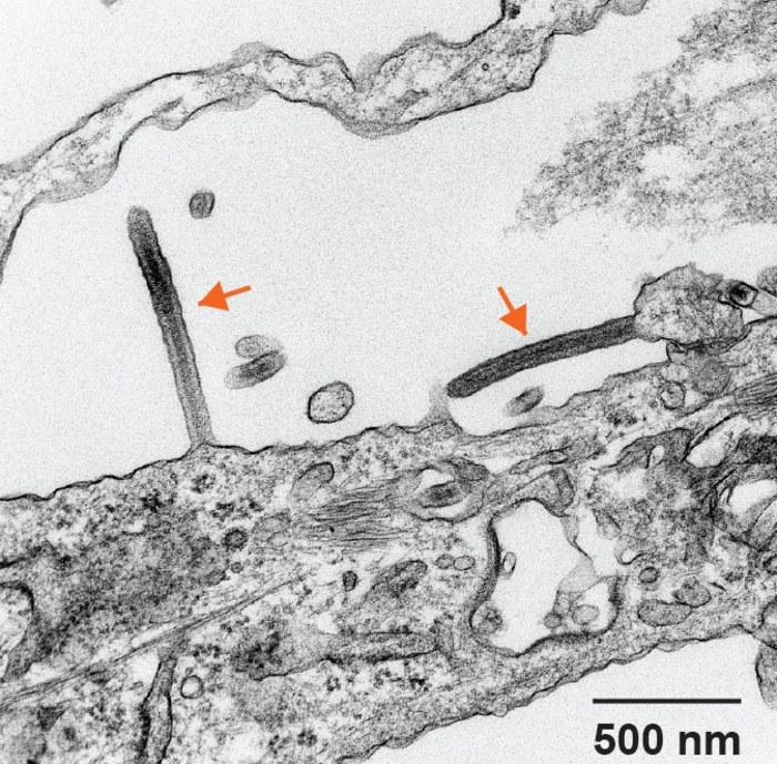 Transmission electron microscopy of iPSC-derived human hepatocyte-like cells infected with Ebola virus.