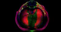 Embryonic Mouse Diaphragm