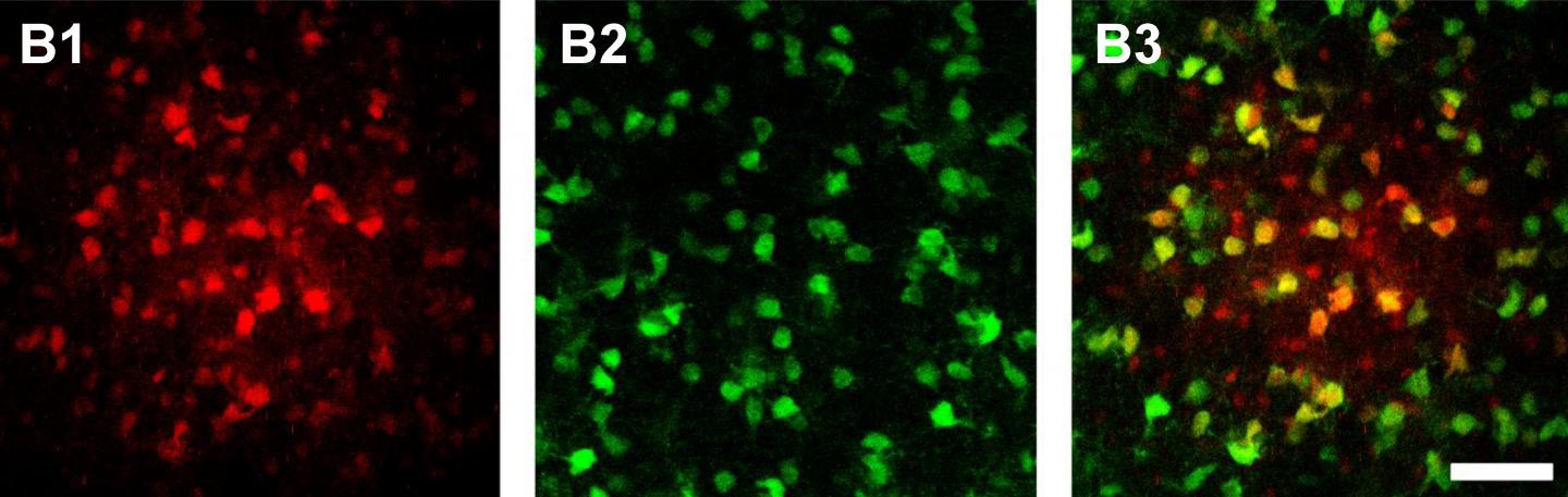 Nerve cells