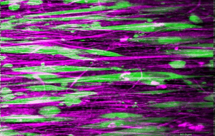 Human Rotator Cuff Tendon Fibroblasts on Aligned Nanofibers