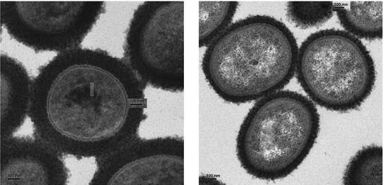 Electron Microscopy of <i>Acinetobacter baumannii</i> Forms