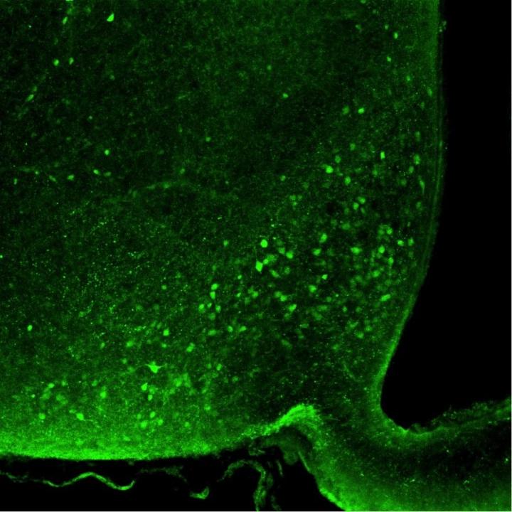 Nociceptin Neurons