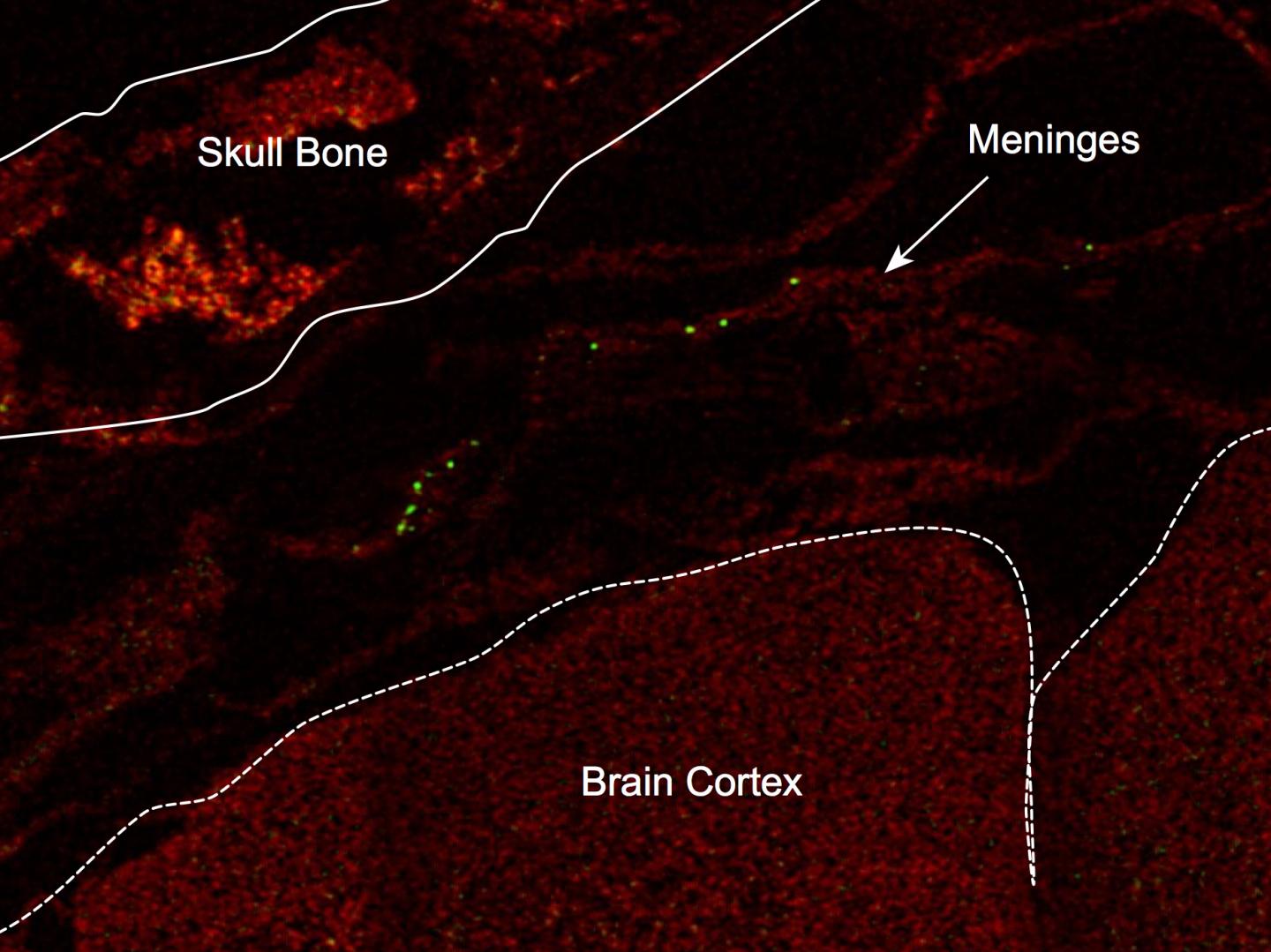 Immune Cells Protect Brain from Stroke