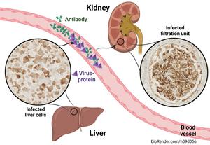 How hepatitis E affects the kidney