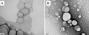 Nanoparticles containing natural substance treat visceral leishmaniasis with scant side effects