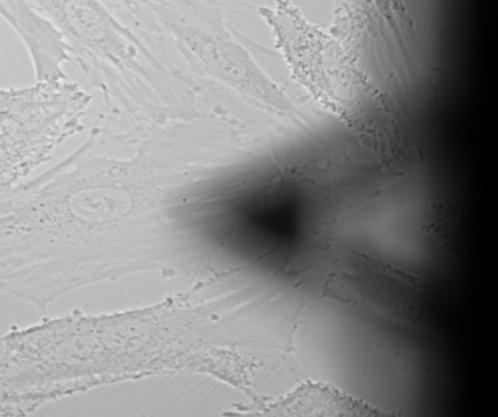 Human Aortic Endothelial Cell