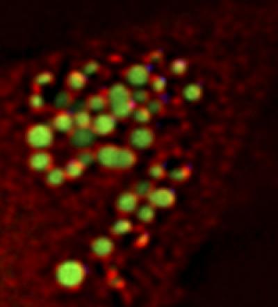 Spartin Localizes on Surface of Lipid Droplets
