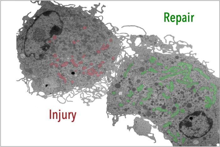 Macrophages in wound healing