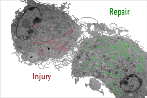 Macrophages in wound healing