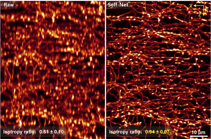 Fig. 3 | The results of using the proposed 3D resolution isotropic restoration method to restore the image volume of axo-axonic cells.