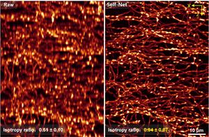 Fig. 3 | The results of using the proposed 3D resolution isotropic restoration method to restore the image volume of axo-axonic cells.