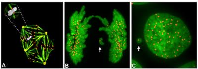 Chromosome Encased in a Micronucleus