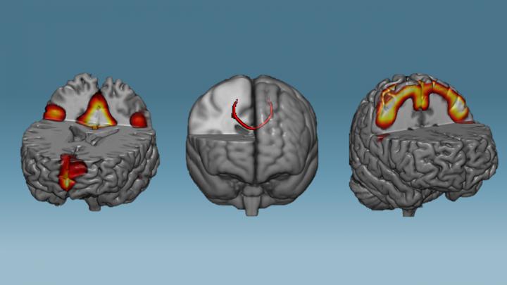 Neural networks after brain training.