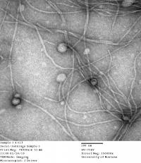 EM Image of Pseudomonas Phage Pf