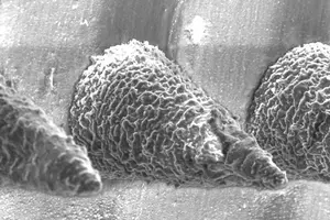 Microscopic view of the microneedles.