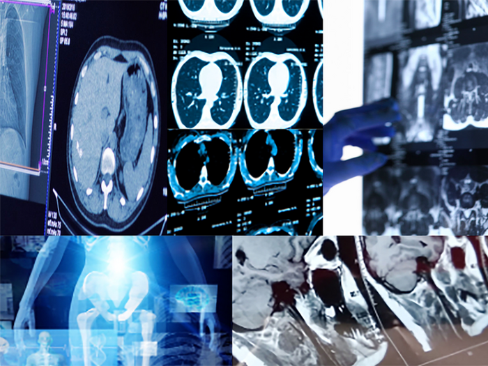 Collection of radiology images