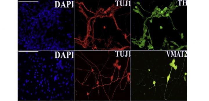 Jumping genes help make neurons in a dish