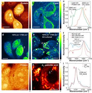 Figure 2| T-SRS-based live-cell chemical imaging.