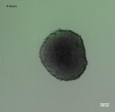 Video: Engineered Bacteria Invade a Tumor Spheroid in a Dish