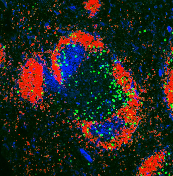 The immune system’s T cells (green) helping B cells (in the red zone) to make antibody responses inside the spleen. Credit Garvan