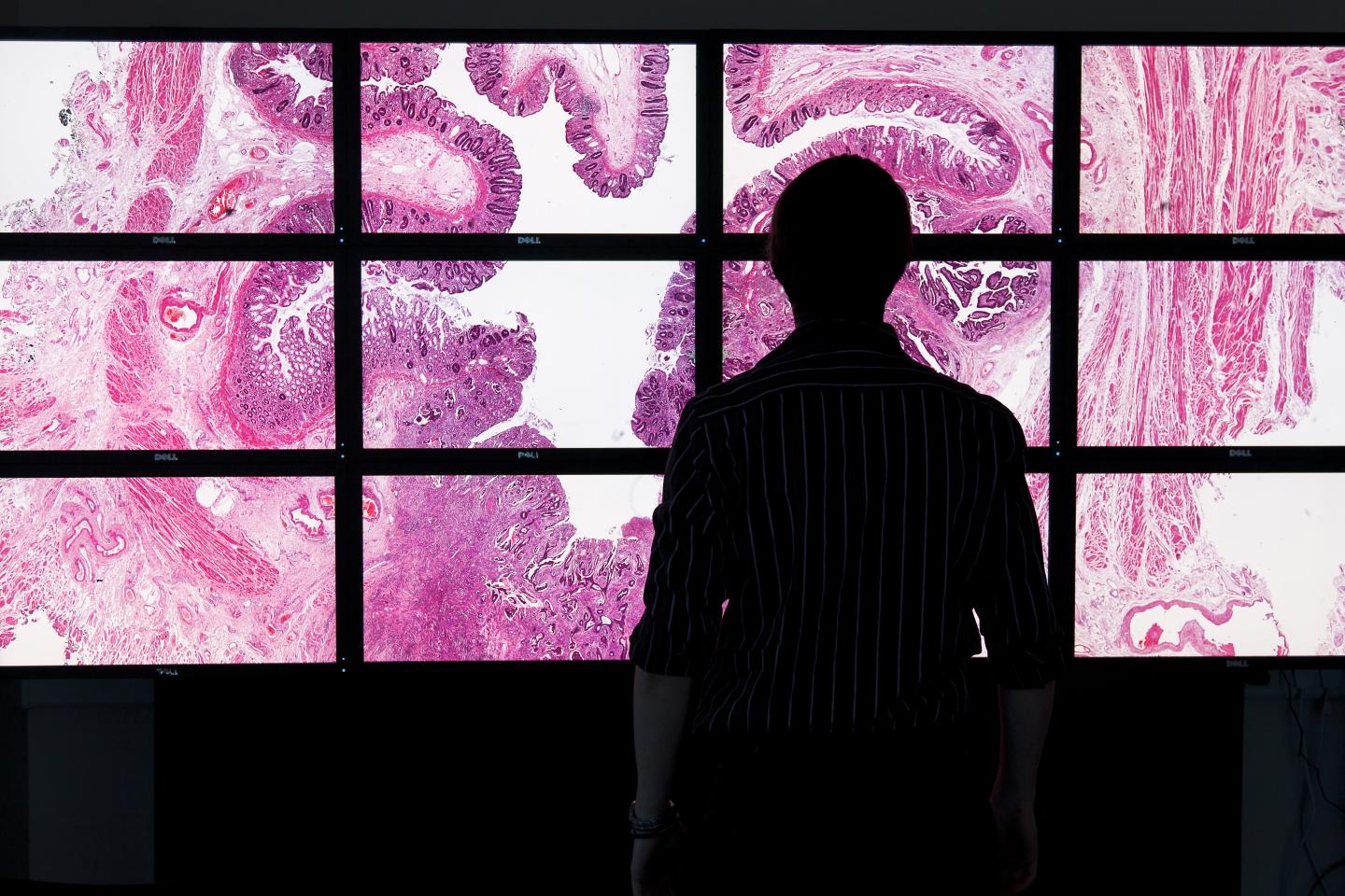 Digital Pathology in Leeds