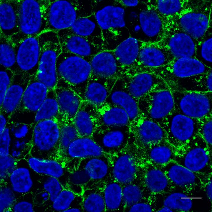 Mislocalized Glut1 Protein