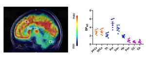 Clinical translation of 18F-Cholestify in healthy volunteers.