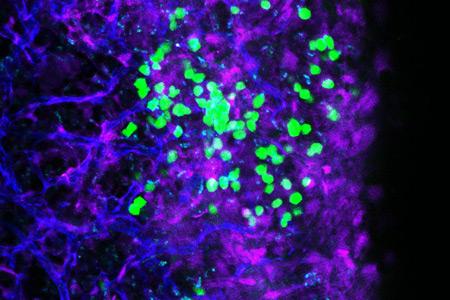 Leukemia Cells, Tannishtha Reya, UC San Diego School of Medicine